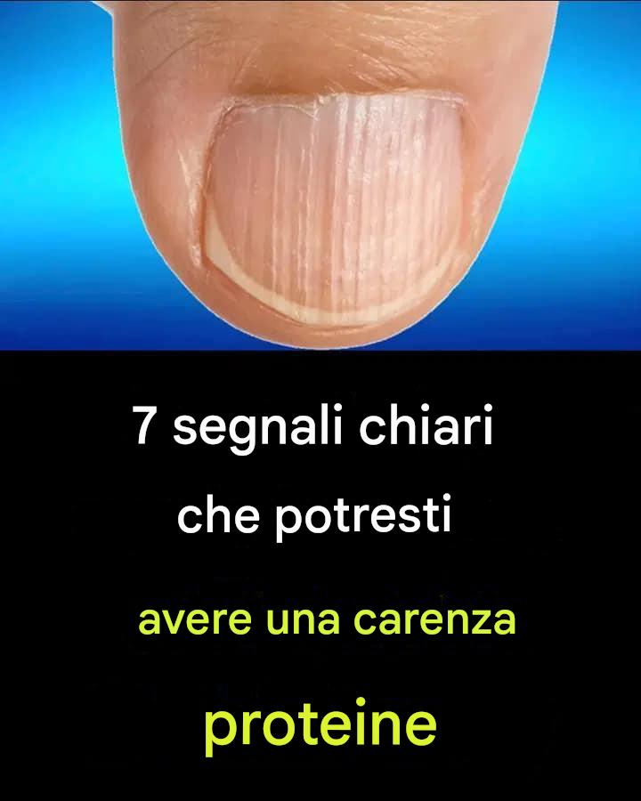 7 Segnali di Carenza di Proteine