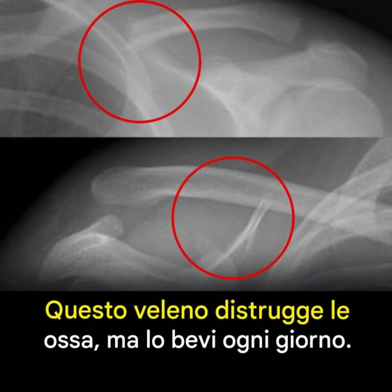 Una bevanda che indebolisce le ossa dall’interno verso l’esterno