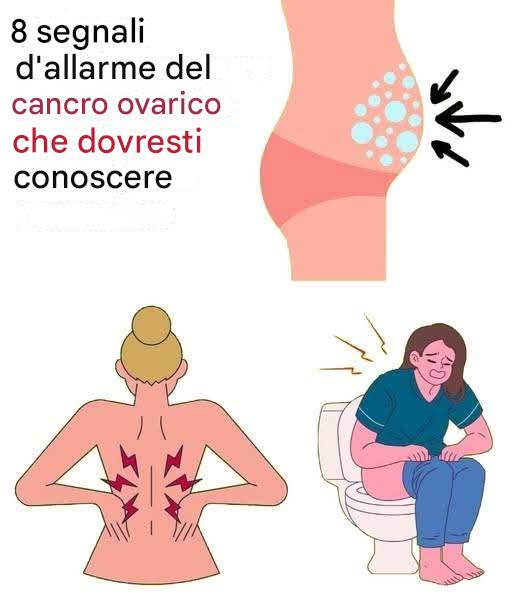 8 segnali d’allarme del cancro ovarico che non dovresti ignorare
