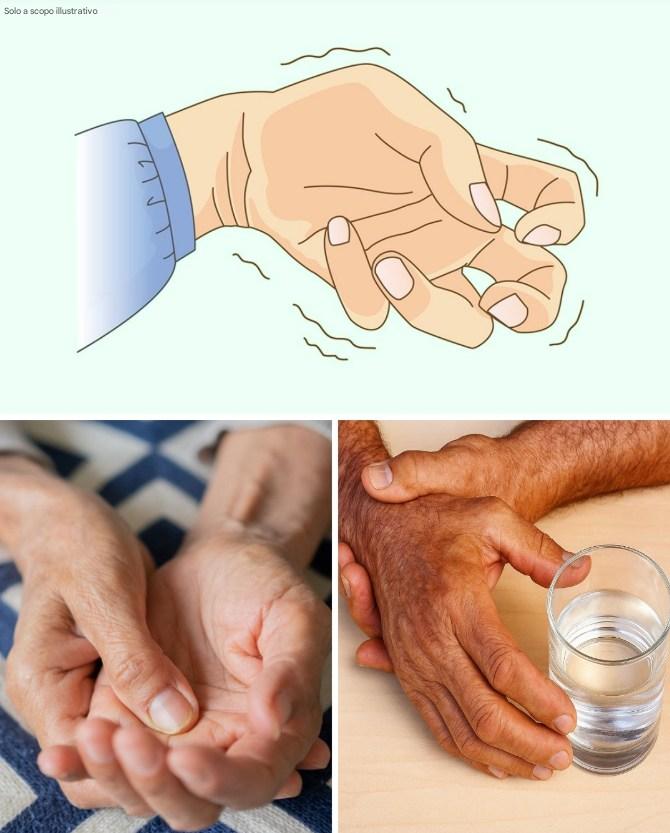 Non solo paura del palcoscenico: scoprire la verità dietro il tremore rivelato…