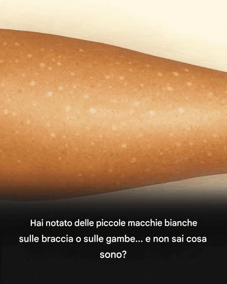 Macchie bianche sulla pelle: perché compaiono e cosa sapere