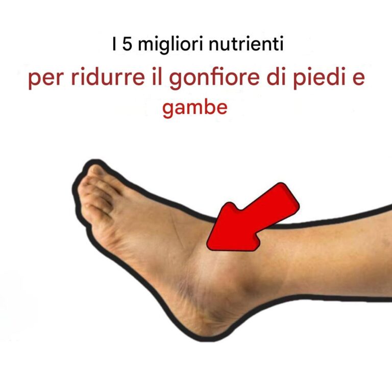 I 5 migliori nutrienti per ridurre il gonfiore di piedi e gambe