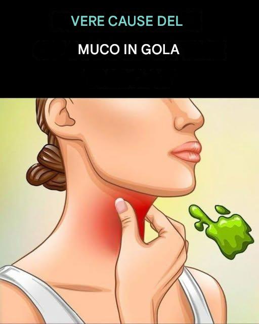 Le vere cause del catarro e del muco costanti in gola