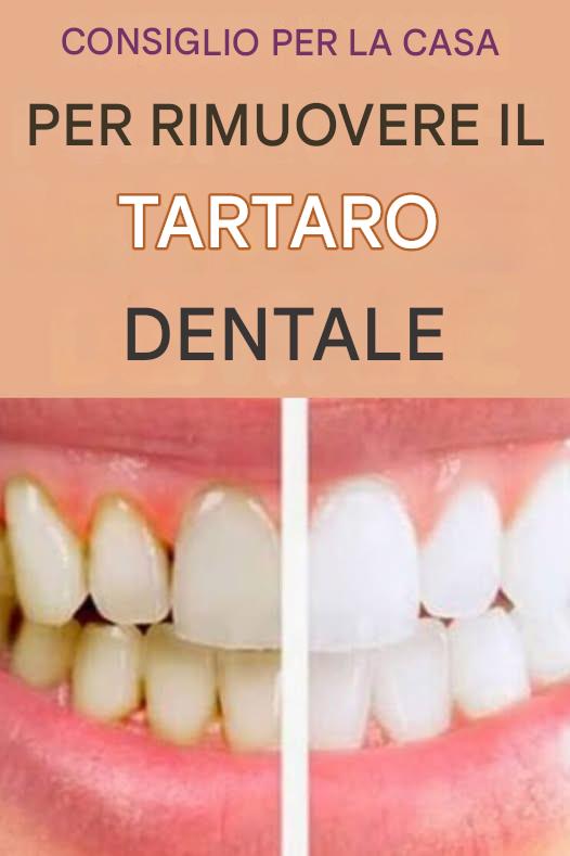 Suggerimento fatto in casa per rimuovere il tartaro