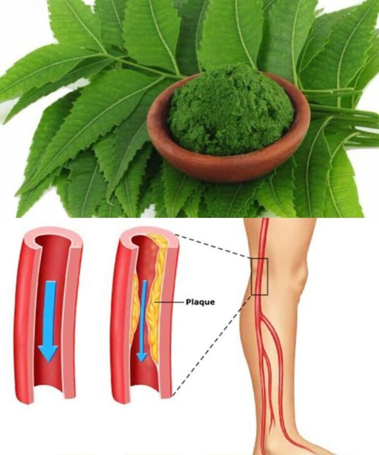 NEEM: PIANTA ANTICA DAI BENEFICI