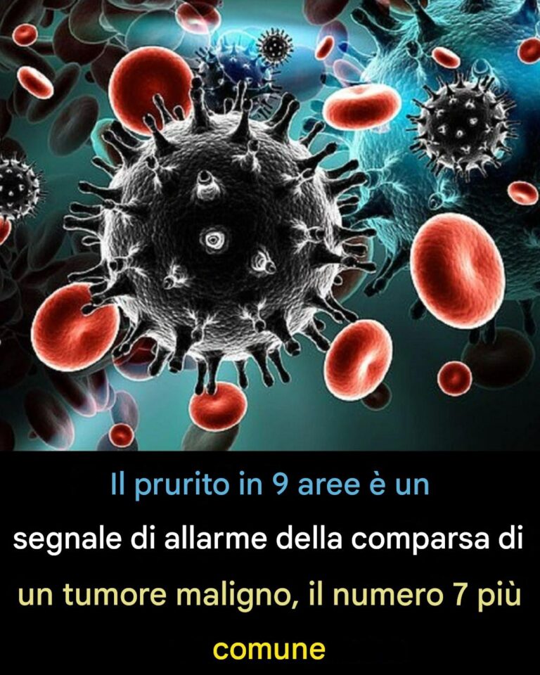 PRURITO PERSISTENTE IN 9 AREE DEL CORPO